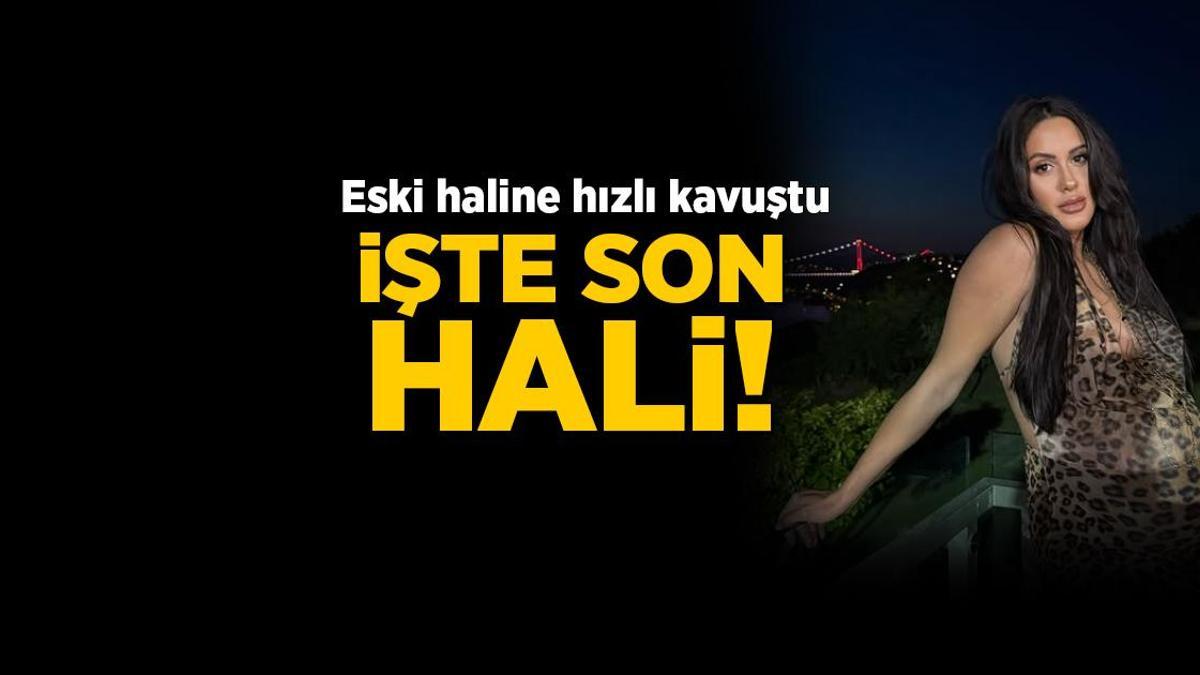 Doğum kilolarından hızlı kurtuldu! Survivor Sahra eski formuna kavuştu: İşte son hali